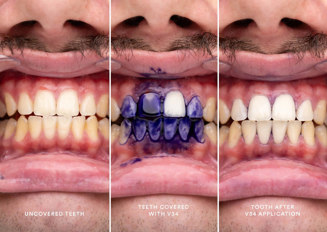 THE SCIENCE BEHIND HALASMILE'S V34 SERUM EXPLAINED